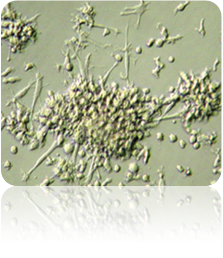 树突细胞